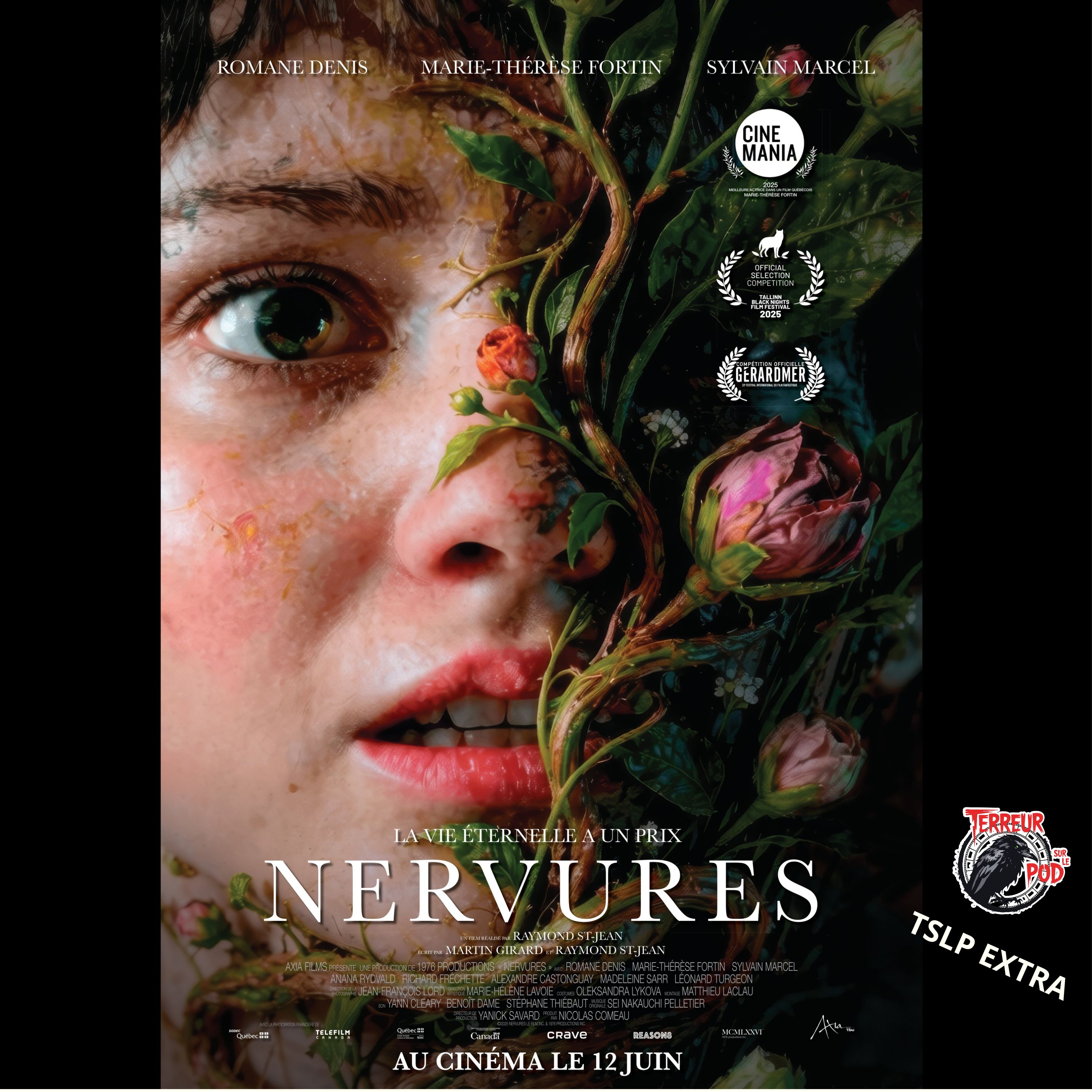 TSLP EXTRA - NERVURES